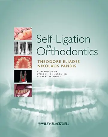 Cover of Self-Ligation in Orthodontics