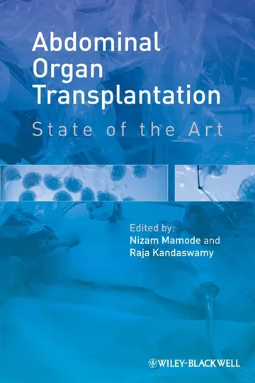 Cover of Abdominal Organ Transplantation - State of the Art