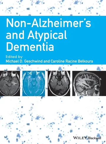 Cover of Non Alzheimers and Atypical Dementia