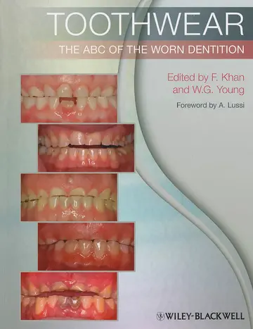 Cover of Toothwear the Abc of the Worn Dentition
