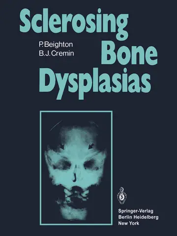 Cover of Sclerosing Bone Dysplasias