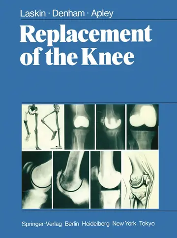 Cover of Replacement of the Knee