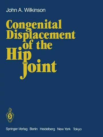 Cover of Congenital Displacement of the Hip Joint