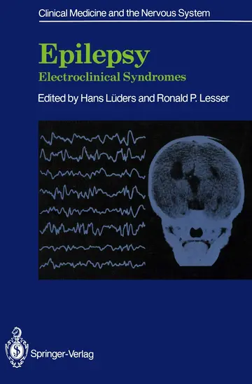 Cover of Epilepsy