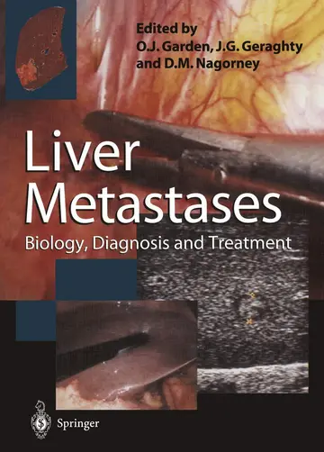Cover of Liver Metastases