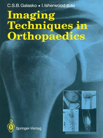 Cover of Imaging Techniques in Orthopaedics