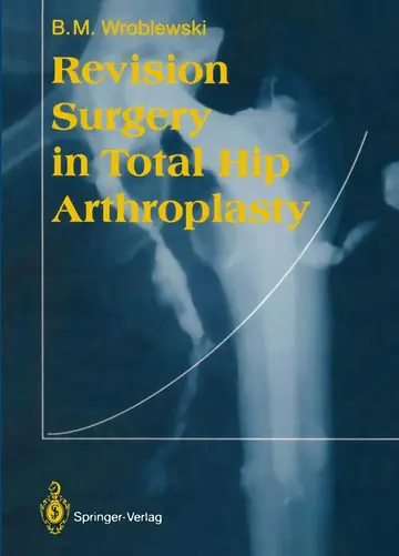 Cover of Revision Surgery in Total Hip Arthroplasty