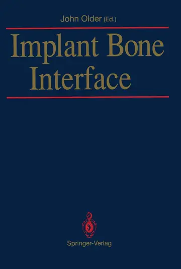 Cover of Implant Bone Interface