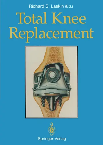 Cover of Total Knee Replacement
