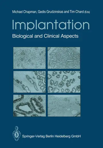 Cover of Implantation