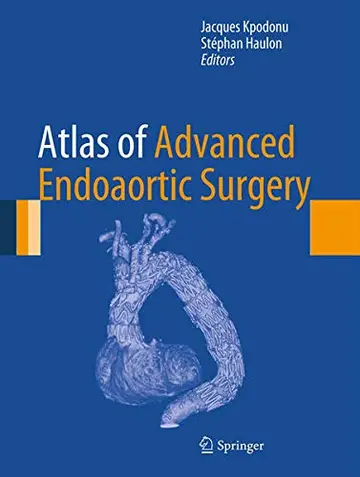 Cover of Atlas of Advanced Endoaortic Surgery