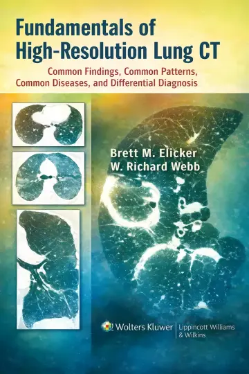Cover of Fundamentals of High-Resolution Lung CT
