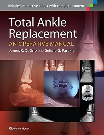 Cover of Total Ankle Replacement an Operative Manual