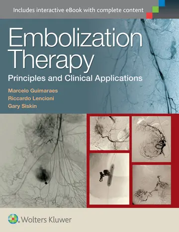 Cover of Embolization Therapy