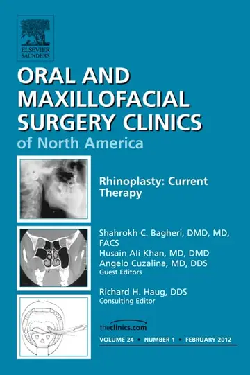 Cover of Rhinoplasty