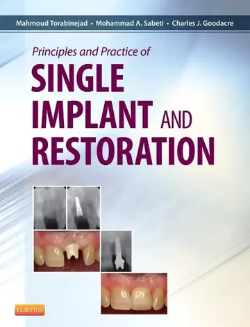Cover of Principles and Practice of Single Implant and Restoration