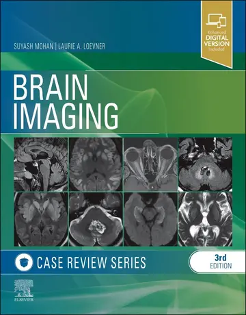 Cover of Brain Imaging