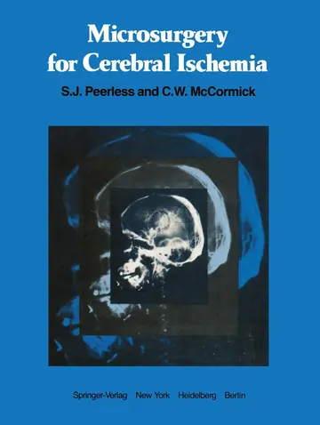 Cover of Microsurgery for Cerebral Ischemia