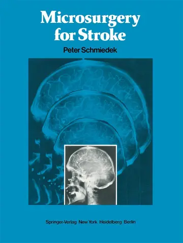 Cover of Microsurgery for Stroke