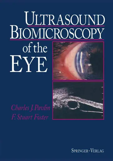 Cover of Ultrasound Biomicroscopy of the Eye