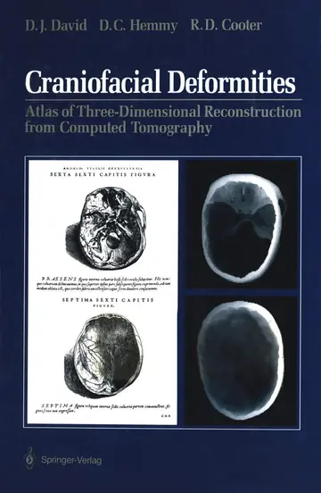 Cover of Craniofacial Deformities
