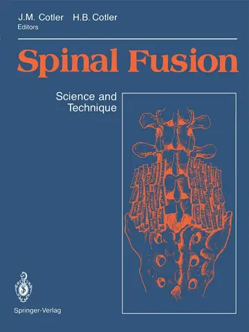 Cover of Spinal Fusion