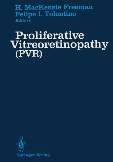 Cover of Proliferative Vitreoretinopathy (PVR)