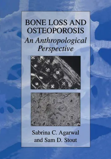 Cover of Bone Loss and Osteoporosis