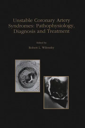 Cover of Unstable Coronary Artery Syndromes Pathophysiology, Diagnosis and Treatment