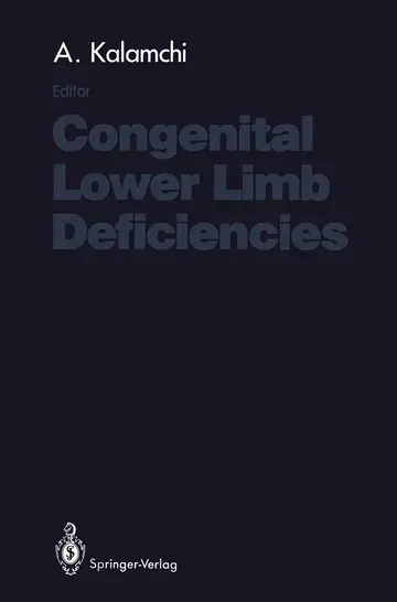 Cover of Congenital Lower Limb Deficiencies