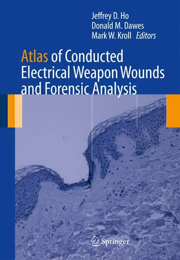 Cover of Atlas of Conducted Electrical Weapon Wounds and Forensic Analysis