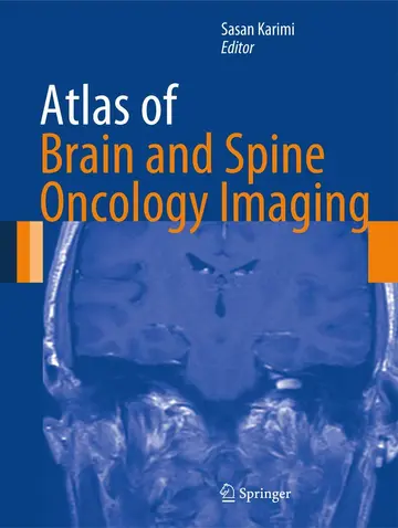 Cover of Atlas of Brain and Spine Oncology Imaging