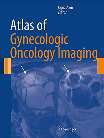 Cover of Atlas of Gynecologic Oncology Imaging