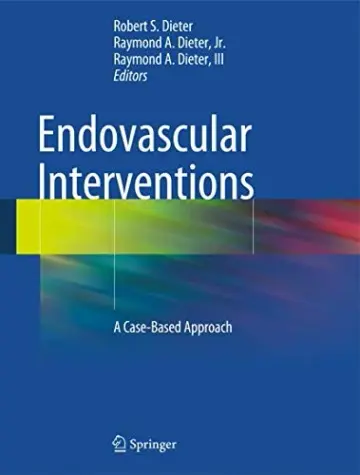 Cover of Endovascular Interventions