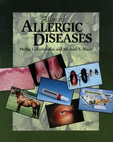 Cover of Atlas of Allergic Diseases