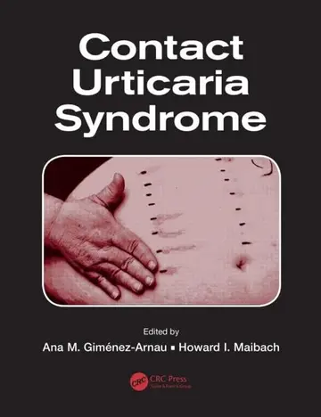 Cover of Contact Urticaria Syndrome