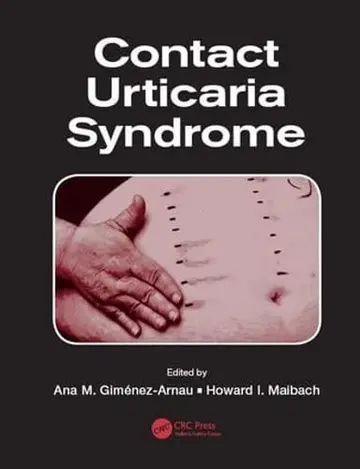Cover of Contact Urticaria Syndrome