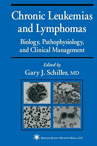 Cover of Chronic Leukemias and Lymphomas