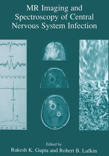 Cover of Mr Imaging and Spectroscopy of Central Nervous System Infection