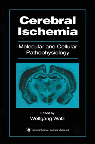 Cover of Cerebral Ischemia