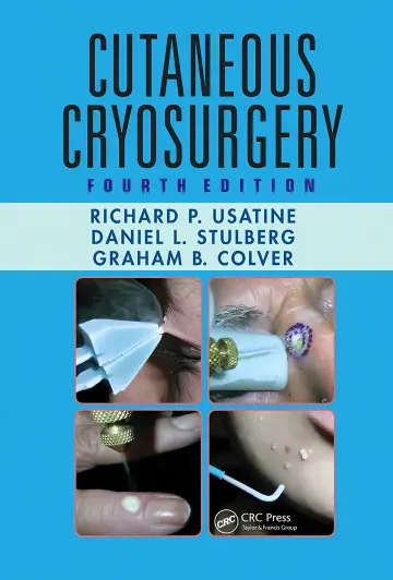 Cover of Cutaneous Cryosurgery