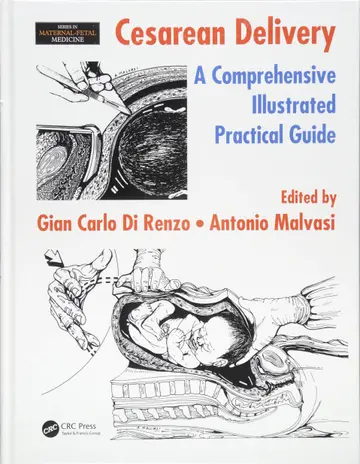 Cover of Cesarean Delivery