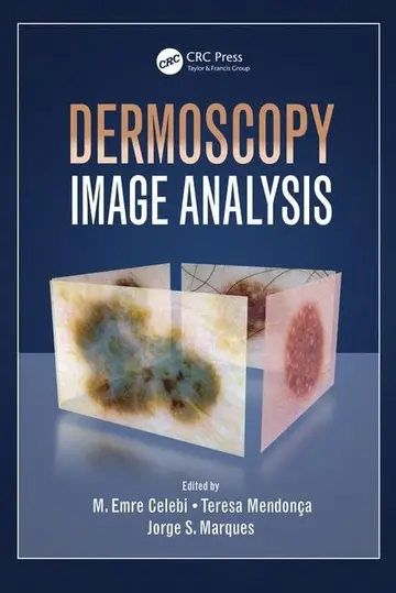 Cover of Dermoscopy Image Analysis
