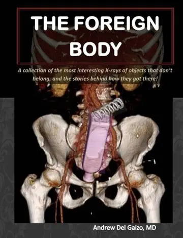 Cover of The Foreign Body
