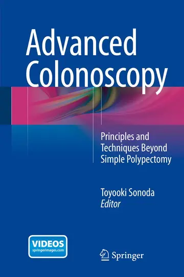 Cover of Advanced Colonoscopy