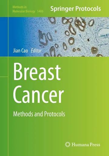 Cover of Breast Cancer