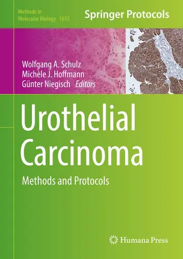 Cover of Urothelial Carcinoma