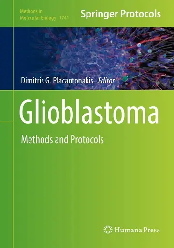 Cover of Glioblastoma