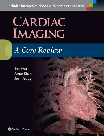 Cover of Cardiac Imaging a Core Review