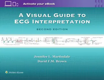 Cover of Visual Guide to ECG Interpretation